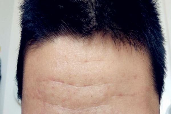 额头看命运的凶吉