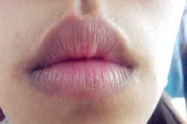 嘴巴面相学解析