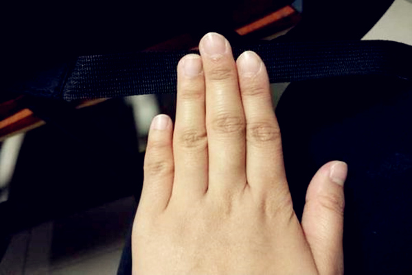 男人小拇指短代表什么