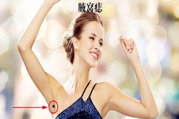 腋窝附近长痣代表什么