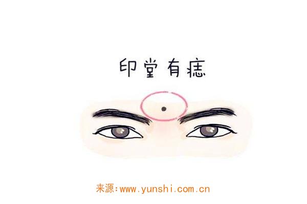 命宫痣是善痣还是恶痣