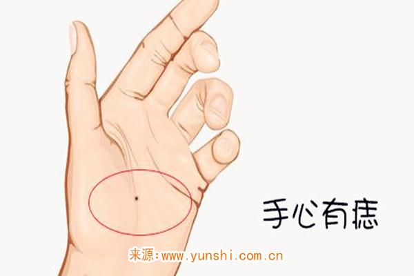 掌心有痣的女人好吗