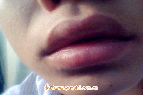 嘴唇厚的男生值得嫁吗