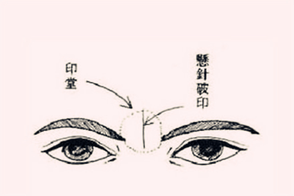 女人悬针纹的面相