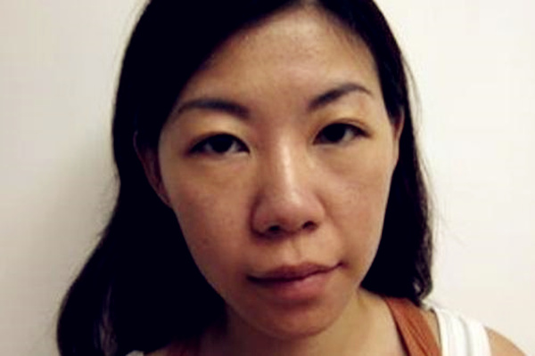 体弱命短的女人面相特征