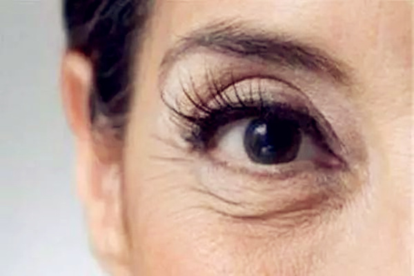 女人鱼尾纹的面相