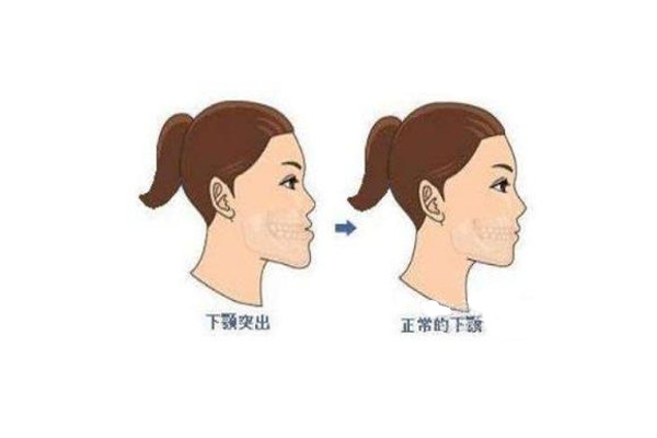 下颌看命运凶吉