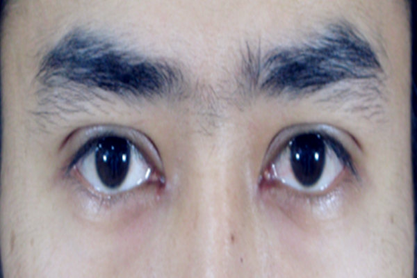 双眼皮的男人命好吗