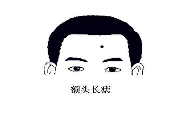 额头长痣命好吗