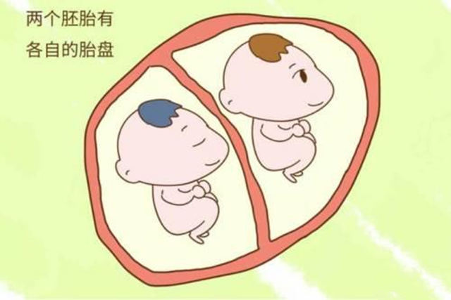 生双胞胎的风水有哪些特征? 生双胞胎的风水有哪些特征?