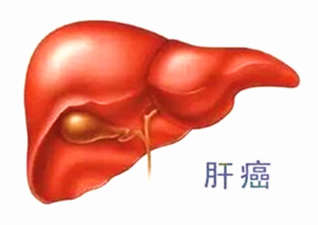 肝癌是哪里风水出了问题