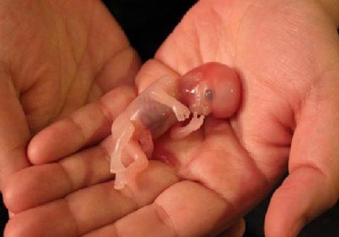 女人打胎后的风水忌讳