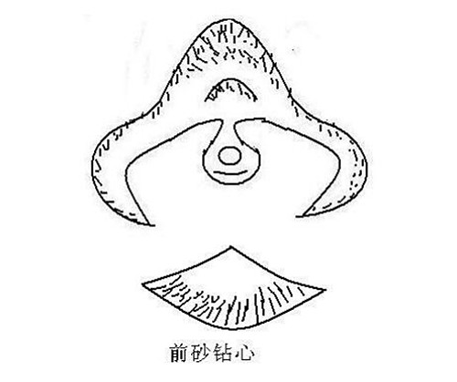 黄肿大脚心病死亡断法