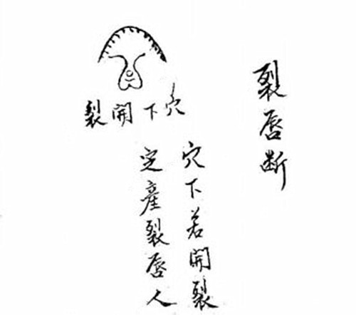 阴宅穴位裂唇断法？