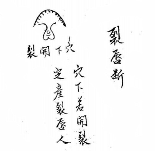 阴阳宅裂唇断法？