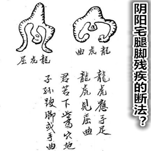 阴阳宅腿脚残疾的断法？