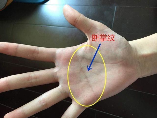 手相问题能解决吗