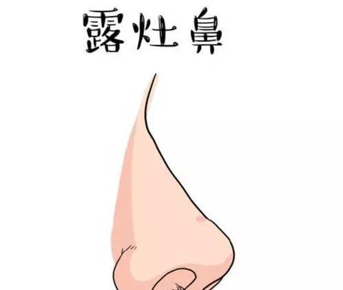 鼻子露孔风水怎么解决