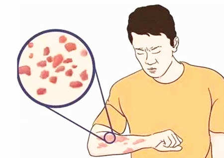 造成皮肤病的风水